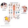Rüdiger Lower Extremity Anatomy Educational Wall Chart 100 x 70 cm, Medical Teaching Aid view 2