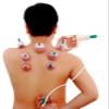 Kangzhu 12-Cup Biomagnetic Chinese Cupping Therapy Set view 2