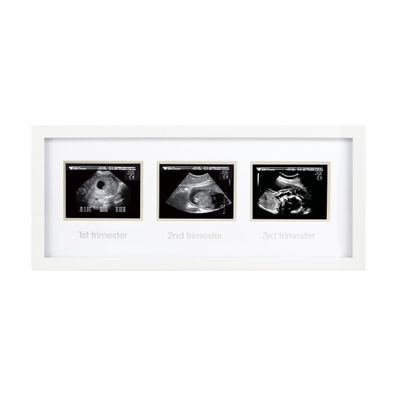 Pearhead 87038 Trimester Sonogram Frame Deluxe, Photo Frame for Three Ultrasound Images, White