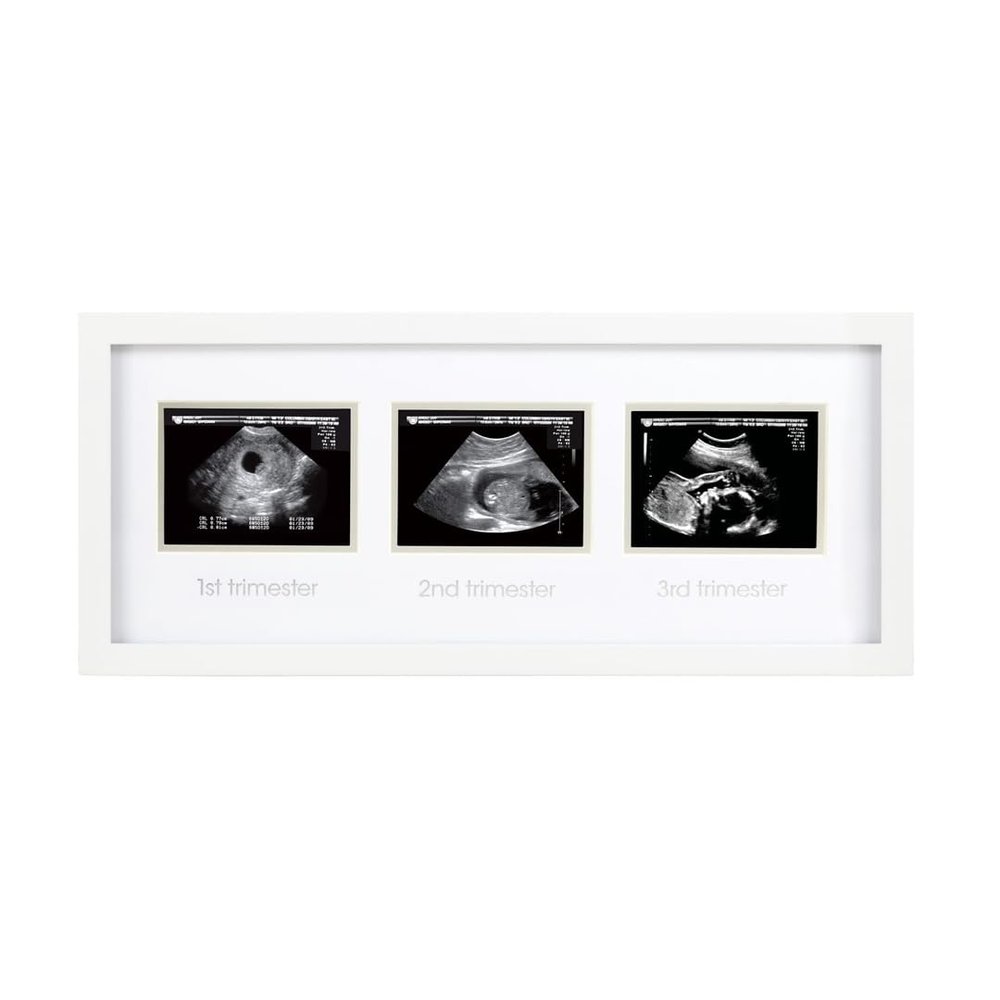Pearhead 87038 Trimester Sonogram Frame Deluxe, Photo Frame for Three Ultrasound Images, White