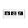 Pearhead 87038 Trimester Sonogram Frame Deluxe, Photo Frame for Three Ultrasound Images, White view 1