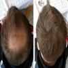 Plus Additional Hair Hair Fibers – Blonde view 3