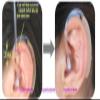JYTOP 18-Piece Hearing Aid Eartips with 6 Tubes, Domes, Sizes S/M/L view 4