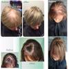 100% Human Hair Clip-In Hairpiece with Side Bangs, Handmade Mono Topper for Thinning Hair, 35.6 cm, #613 Blonde view 3