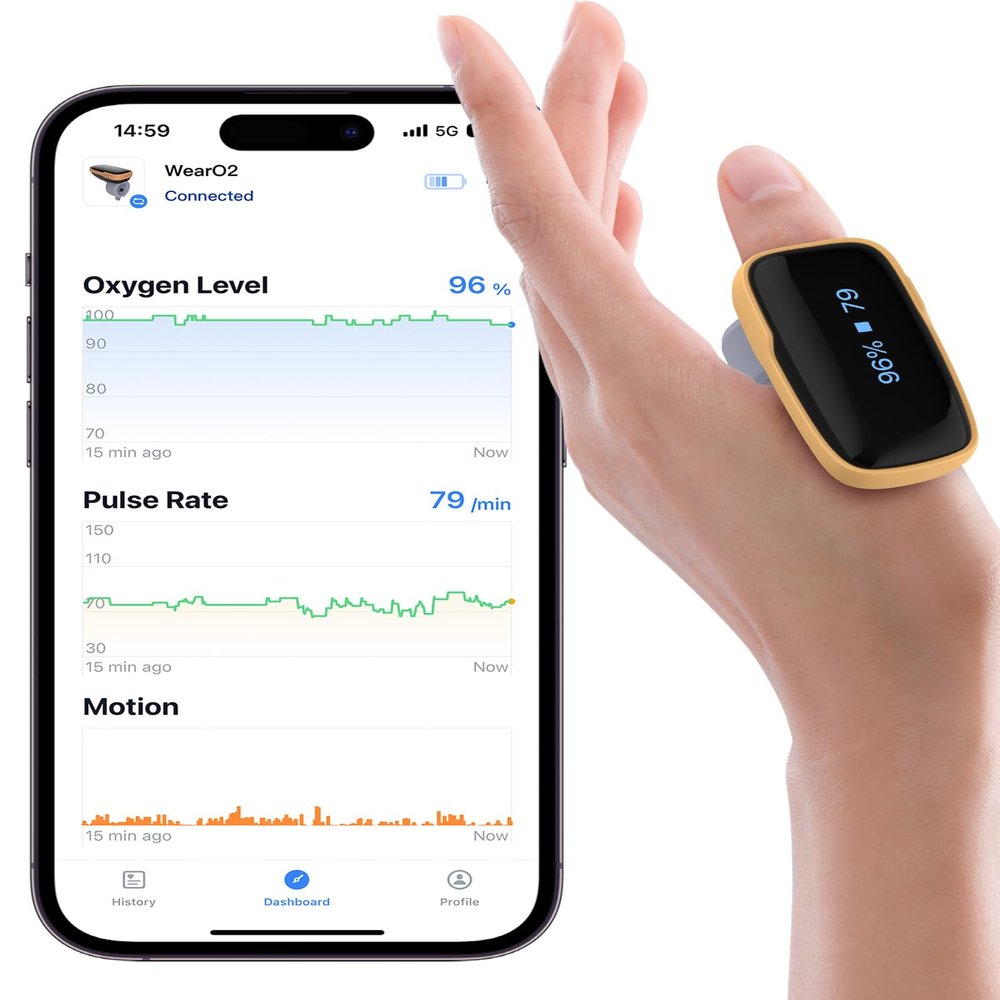 Viatom WearO2 Rechargeable Bluetooth Pulse Oximeter with Sleep Analysis and Vibration Alarm