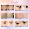 Elitzia 7-Color LED Photon Beauty Device view 4