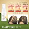 20 mL Ginger Hair Growth Spray, 1pc view 4