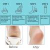 NICENEEDED Nano Foot File and Callus Remover view 4