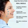 Angel Kiss Derma Roller – 192 Genuine Titanium Needles, 0.25 mm, Face & Body view 3