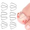 Ingrown Toenail Correction Tool Set view 1