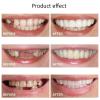 XZLZMD Silica Gel Cosmetic Teeth for a Perfect Smile, Upper and Lower Jaw, 8 Pairs view 4