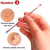 Blackhead Remover and Tweezer Set, Stainless Steel view 4