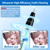 Ni-SHEN Dog Dental Cleaning Kit, Ultrasonic Pet Tooth Cleaner for Dogs and Cats, Black view 3