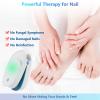 Nail Fungus Laser Treatment Device, Nail Cleaner for Toenails and Fingernails, Onychomycosis Remover for Home Use with 470 nm Blue Light, 660 nm Red Light and 905 nm Infrared Light (White) view 3