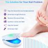 Nail Fungus Laser Treatment Device, Nail Cleaner for Toenails and Fingernails, Onychomycosis Remover for Home Use with 470 nm Blue Light, 660 nm Red Light and 905 nm Infrared Light (White) view 4
