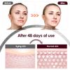 3-in-1 RF EMS Portable Mini HIFU Facial Lifting and Skin Care Device view 4