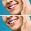MXRFACTory Instant Cosmetic Upper and Lower Veneers, Natural Shade, Removable Denture Restoration Kit, 11 Pairs view 2