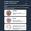 Rehabilitation Robot Finger Orthosis for Hemiplegia, Arthritis and Wrist Pain Relief view 4