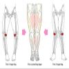Adjustable Leg Correction Belt for O-Legs/X-Legs, Pink view 2