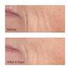 Perricone MD Cold Plasma Plus+ Concentrated Treatment Sheet Mask view 3