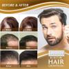 Re'awaken Hair & Beard Serum Spray, Hair and Beard Growth Serum, Anti-Hair Loss Serum, Biotin Oil, 1 Piece view 4