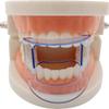 Ericetion 5pcs Mouth Retractor Set view 2