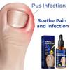 2-Piece German ToenailCare Ingrown Toenail Treatment Oil view 2