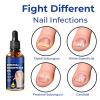 2-Piece German ToenailCare Ingrown Toenail Treatment Oil view 3