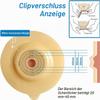 10 Stoma Bags, One-Piece Drainable Ostomy Pouches with Clip Closure, for Ileostomies, Up to 45 mm view 2