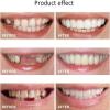 EMERZE False Teeth Veneers, Silicone Prostheses, Cosmetic Temporary Dentures, Upper and Lower Matching Set, Unisex, Natural Shade, Comfortable Fit, 5 Pairs view 3