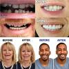 EMERZE False Teeth Veneers, Silicone Prostheses, Cosmetic Temporary Dentures, Upper and Lower Matching Set, Unisex, Natural Shade, Comfortable Fit, 5 Pairs view 4