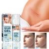 Scar Gel for Acne Scars and Stretch Marks, Advanced Scar Treatment, 50 mL view 2