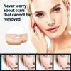 Scar Gel for Acne Scars and Stretch Marks, Advanced Scar Treatment, 50 mL view 4