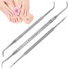Ingrown Toenail Care Set with Corner Lifters and Nail File view 1