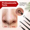 NEUMANN Blackhead Remover Set, Stainless Steel, with Loops, Tweezers and Lancet [Black] view 3