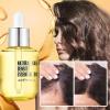 Hovo Hair Density Essential Oil, Hair Regrowth Serum, 2-Piece Set view 2