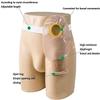Samnuerly Stoma Hernia Belt with Reusable Pouches for Colostomy and Ileostomy Care view 2