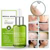 DUBUSH 30 ml Goopgen Medical-Grade Scar Repair Serum view 2