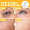 Ame Pure Vitamin C & Retinol Facial Serum, 30 ml view 2