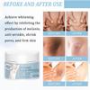 10-Second Instant Whitening Body Cream, Underarm Brightening Cream, Suitable for All Skin Types, 60 g (1 pc) view 4