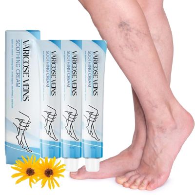 EXQST Raura Varicose Vein Cream – Improves Circulation