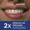 Waterpik Advanced Cordless Water Flosser, 2026 Test Winner, 3 Pressure Settings view 3