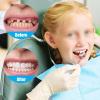 Instant Reusable Fake Teeth, Temporary Upper and Lower Veneers, Cosmetic Dental Appliance, Temporary Dentures, 01, 13 Pieces view 2