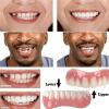 Instant Reusable Fake Teeth, Temporary Upper and Lower Veneers, Cosmetic Dental Appliance, Temporary Dentures, 01, 13 Pieces view 3