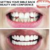 Instant Reusable Fake Teeth, Temporary Upper and Lower Veneers, Cosmetic Dental Appliance, Temporary Dentures, 01, 13 Pieces view 4