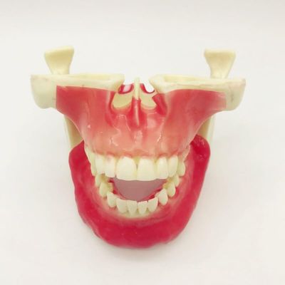 Dental Study Teaching Model, Jaw Implant and Maxillary Sinus Lift Model