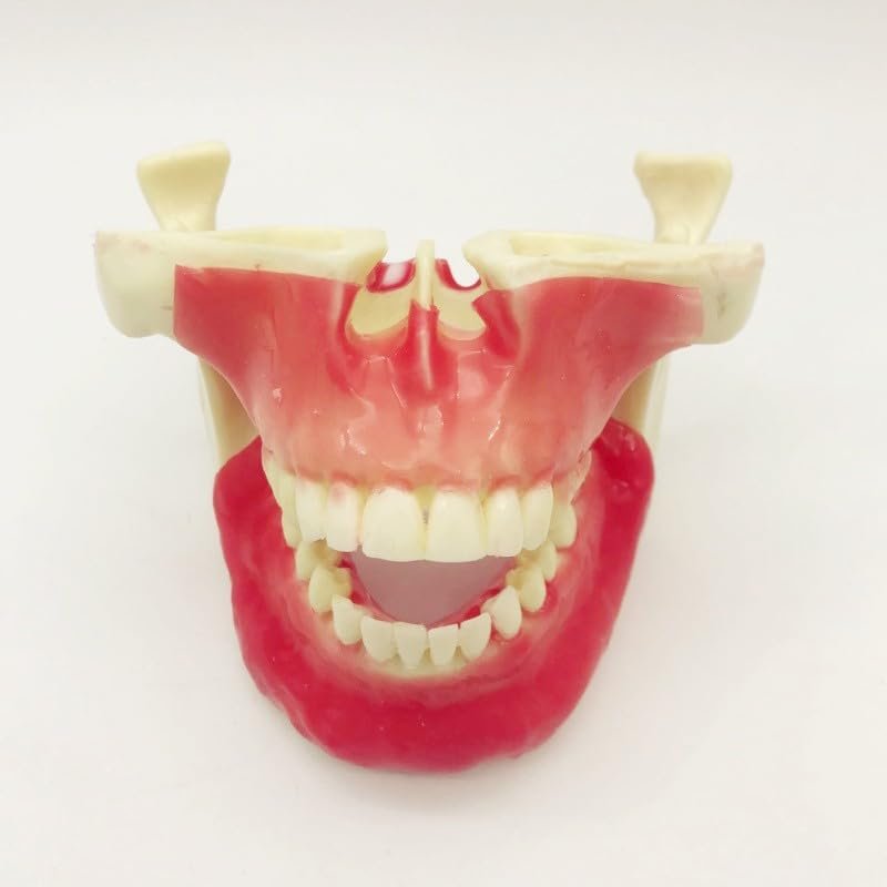 Dental Study Teaching Model, Jaw Implant and Maxillary Sinus Lift Model