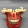 Dental Study Teaching Model, Jaw Implant and Maxillary Sinus Lift Model view 3