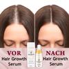 Hair Serum for Women’s Hair Loss & Growth, 100 ml view 4