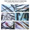 Portable 7-Inch HD LCD Skin and Scalp Analyzer, 50x/200x, Plug-In Model view 4